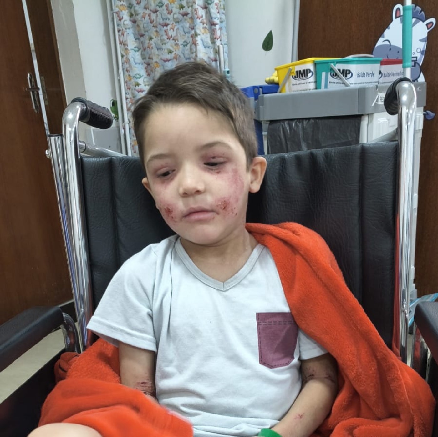 Luicito en silla de ruedas durante su atención médica